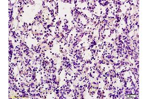 Immunohistochemistry (IHC) image for anti-Tumor Necrosis Factor (Ligand) Superfamily, Member 10 (TNFSF10) (AA 185-281) antibody (ABIN673494)