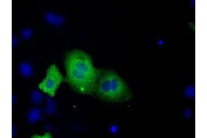 Image no. 11 for anti-Transforming, Acidic Coiled-Coil Containing Protein 3 (TACC3) antibody (ABIN1498097) (TACC3 抗体)