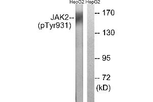 Immunohistochemistry analysis of paraffin-embedded human brain tissue using JAK2 (Phospho-Tyr931) antibody. (JAK2 抗体  (pTyr931))