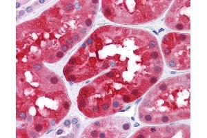 Immunohistochemistry (IHC) image for anti-Tetratricopeptide Repeat Domain 1 (TTC1) (AA 193-293) antibody (ABIN574360)