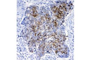 IHC analysis of GSTA1/A2/A3/A4/A5 using anti-GSTA1/A2/A3/A4/A5 antibody (ABIN5518995). (GSTA1 抗体  (AA 2-222))
