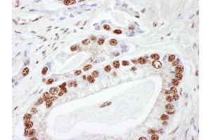 Immunohistochemistry (IHC) image for anti-Protein Kinase, DNA-Activated, Catalytic Polypeptide (PRKDC) (AA 2100-2150) antibody (ABIN7448533) (PRKDC 抗体  (AA 2100-2150))