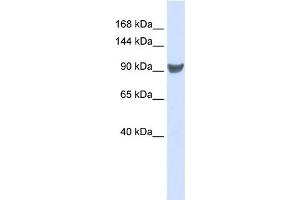 WB Suggested Anti-XPO1 Antibody Titration:  0. (XPO1 抗体  (Middle Region))
