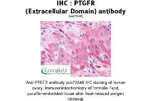 Image no. 1 for anti-Prostaglandin F Receptor (FP) (PTGFR) (1st Extracellular Domain) antibody (ABIN1738570) (PTGFR 抗体  (1st Extracellular Domain))