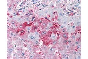 Immunohistochemical (Formalin/PFA-fixed paraffin-embedded sections) staining in human liver with DUSP26 polyclonal antibody . (DUSP26 抗体)