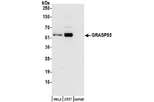 Western Blotting (WB) image for anti-Golgi Reassembly Stacking Protein 2, 55kDa (GORASP2) (AA 400-450) antibody (ABIN7455047)