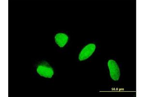 Immunofluorescence of monoclonal antibody to KLHDC4 on HeLa cell. (KLHDC4 抗体  (AA 1-463))