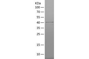 Western Blotting (WB) image for Organic Anion Transporter H (OATP-H) (AA 1-101) protein (His-IF2DI Tag) (ABIN7282532) (SLCO4C1 Protein (AA 1-101) (His-IF2DI Tag))