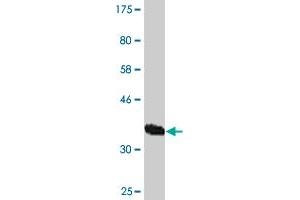Western Blot detection against Immunogen (36. (VPS18 抗体  (AA 3-100))