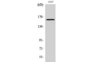 Western Blotting (WB) image for anti-RAB3 GTPase Activating Protein Subunit 2 (Non-Catalytic) (RAB3GAP2) (Internal Region) antibody (ABIN3180288) (RAB3GAP2 抗体  (Internal Region))