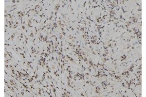 ABIN6272929 at 1/100 staining Human gastric tissue by IHC-P. (SKAP2 抗体  (C-Term))
