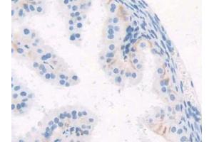 IHC-P analysis of Mouse Oviduct Tissue, with DAB staining. (WISP1 抗体  (AA 213-350))