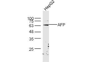 HepG2 lysates probed with AFP Polyclonal Antibody, Unconjugated  at 1:300 dilution and 4˚C overnight incubation. (alpha Fetoprotein 抗体  (AA 501-609))