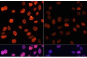 Immunofluorescence analysis of HeLa cells using Acetyl-Histone H4-K91 Polyclonal Antibody at dilution of 1:100. (Histone H4 抗体  (acLys91))