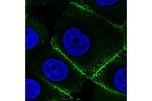 Immunofluorescent staining of MCF7 cells with EZR monoclonal antibody, clone CL2384  (Green) shows specific plasma membrane.