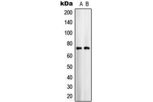 Western blot analysis of ARALAR1 expression in COLO205 (A), U251MG (B) whole cell lysates.