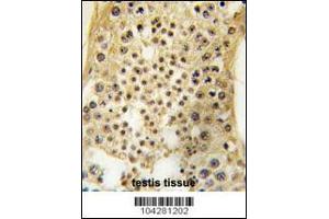 Formalin-fixed and paraffin-embedded human testis tissue reacted with USP7 antibody , which was peroxidase-conjugated to the secondary antibody, followed by DAB staining. (USP7 抗体  (C-Term))