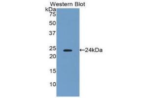 Western Blotting (WB) image for anti-Interferon, beta 1, Fibroblast (IFNB1) (AA 22-186) antibody (ABIN1859272) (IFNB1 抗体  (AA 22-186))
