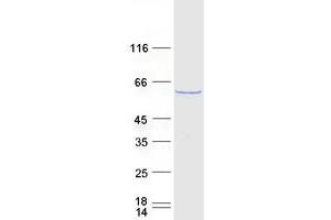 Validation with Western Blot (PTBP1 Protein (Transcript Variant 1) (Myc-DYKDDDDK Tag))
