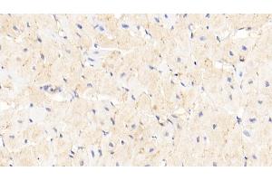 Immunohistochemistry (IHC) image for anti-Advanced Glycosylation End Product-Specific Receptor (AGER) (AA 91-274) antibody (ABIN7432304)