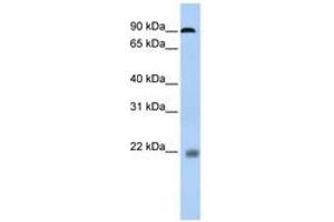 Image no. 1 for anti-Nuclear Factor of Activated T-Cells, Cytoplasmic, Calcineurin-Dependent 1 (NFATC1) (N-Term) antibody (ABIN6742798) (NFATC1 抗体  (N-Term))