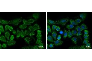 Immunofluorescence (IF) image for anti-ClpP Caseinolytic Peptidase, ATP-Dependent, Proteolytic Subunit Homolog (E. Coli) (CLPP) (C-Term) antibody (ABIN2855887)