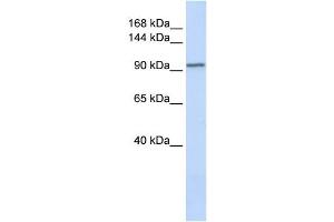 PAM antibody used at 1 ug/ml to detect target protein. (PAM 抗体  (N-Term))