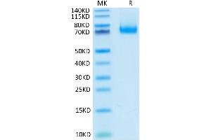Mouse PD-L1 on Tris-Bis PAGE under reduced condition. (PD-L1 Protein (AA 19-237) (Fc Tag))