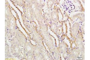 Formalin-fixed and paraffin embedded mouse kidney labeled with Rabbit Anti-APG5L/ATG5 Polyclonal Antibody  at 1:100 followed by conjugation to the secondary antibody and DAB staining. (ATG5 抗体  (AA 101-200))