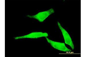 Immunofluorescence of monoclonal antibody to NT5C2 on HeLa cell. (NT5C2 抗体  (AA 1-561))