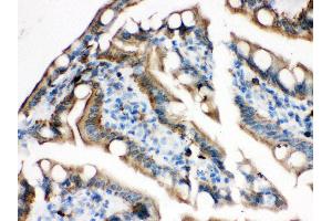 Anti- Plectin Picoband antibody, IHC(P) IHC(P): Rat Intestine Tissue (PLEC 抗体  (Middle Region))