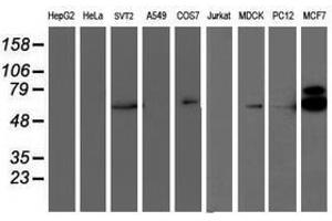 Image no. 3 for anti-Ribosomal Protein S6 Kinase, 70kDa, Polypeptide 1 (RPS6KB1) antibody (ABIN1500001) (RPS6KB1 抗体)