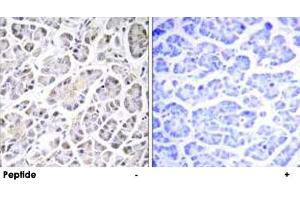 Immunohistochemistry analysis of paraffin-embedded human pancreas tissue using ATP5G3 polyclonal antibody . (ATP5G3 抗体)