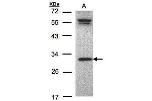 WB Image Sample(30 ug whole cell lysate) A:MOLT4 , 12% SDS PAGE antibody diluted at 1:1000 (ORC6 抗体  (C-Term))