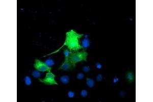 Anti-EPN2 mouse monoclonal antibody (ABIN2455557) immunofluorescent staining of COS7 cells transiently transfected by pCMV6-ENTRY EPN2 (RC213652). (Epsin 2 抗体)