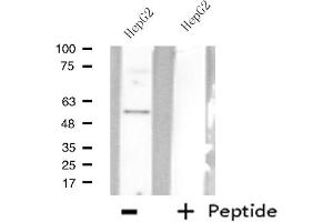 Western blot analysis of extracts from HepG2 cells using AGXT2L2 antibody. (AGXT2L2 抗体  (C-Term))