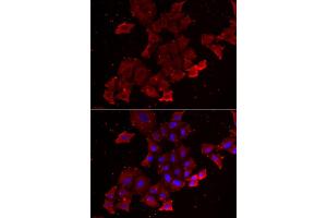 Immunofluorescence analysis of A549 cells using LGALS3BP antibody. (LGALS3BP 抗体)