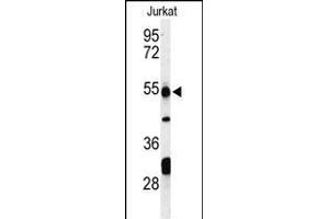 Western blot analysis of PRUNE Antibody (C-term) (ABIN653704 and ABIN2843021) in Jurkat cell line lysates (35 μg/lane).