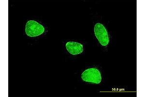 Immunofluorescence of monoclonal antibody to MEF2BNB on HeLa cell . (MEF2BNB 抗体  (AA 1-109))