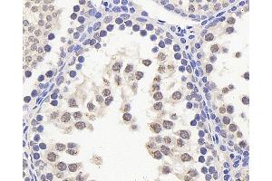 Immunohistochemistry analysis of paraffin-embedded rat testis using HES2 Polyclonal Antibody at dilution of 1:200. (HES2 抗体)