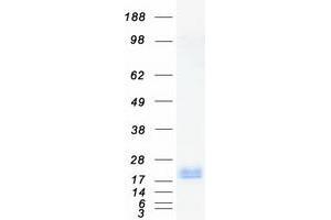 Western Blotting (WB) image for Potassium Voltage-Gated Channel, Isk-Related Family, Member 2 (KCNE2) protein (Myc-DYKDDDDK Tag) (ABIN2724019)