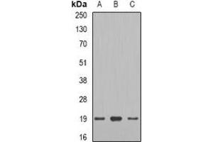 Western blot analysis of Telethonin expression in mouse heart (A), rat heart (B), rat skeletal muscle (C) whole cell lysates. (TCAP 抗体)