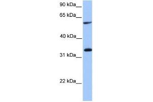 TSKS antibody used at 1 ug/ml to detect target protein. (TSKS 抗体  (Middle Region))