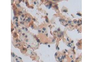 Used in DAB staining on fromalin fixed paraffin- embedded lung tissue (DDC 抗体  (AA 200-420))