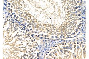 ABIN6259806 and ABIN6278707 at 1/100 staining Rat testis tissue by IHC-P. (ADRA1D 抗体  (C-Term))