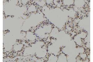 ABIN6269204 at 1/100 staining Rat lung tissue by IHC-P. (SHP1 抗体  (C-Term))