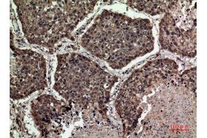 Immunohistochemistry (IHC) analysis of paraffin-embedded Human Lung, antibody was diluted at 1:100.