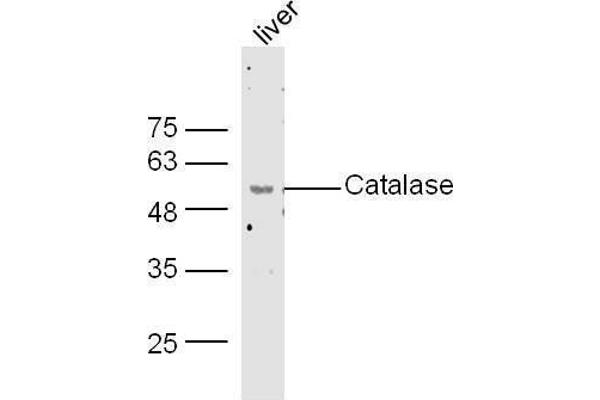 Catalase 抗体  (AA 251-350)
