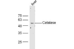 Mouse liver lysates probed with Rabbit Anti-Catalase Polyclonal Antibody, Unconjugated  at 1:500 for 90 min at 37˚C. (Catalase 抗体  (AA 251-350))