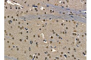 ABIN6263498 and ABIN6268752 at 1/100 staining rat brain tissue by IHC-P. (MYCN 抗体  (Internal Region))